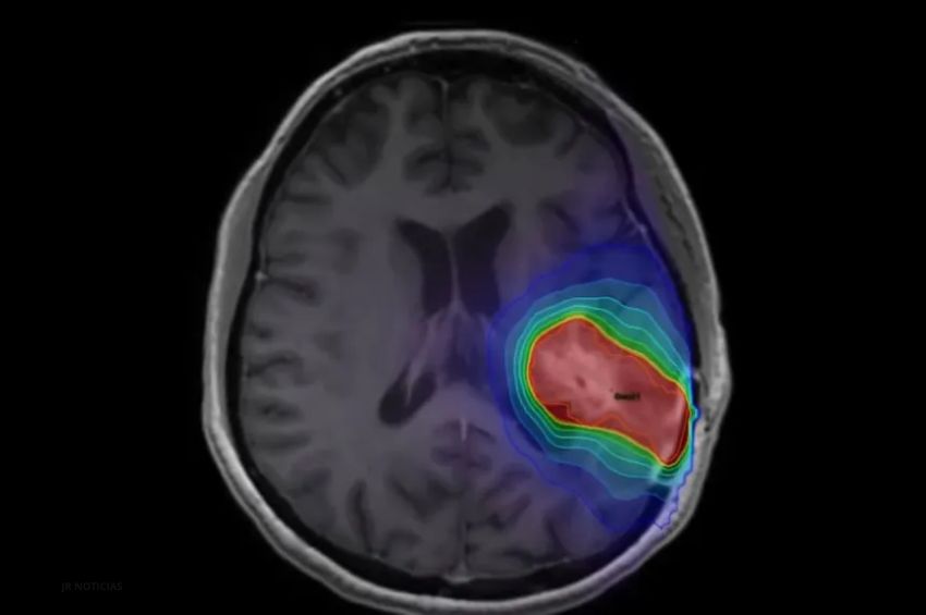 Reciente vacuna hizo que los pacientes sobrevivieran 50% más a un cáncer letal en el cerebro