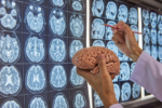 El superalimento que impide que se formen coágulos sanguíneos en tu cerebro por años
