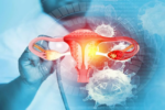 Autoridades afirman que la vacuna contra el Virus del Papiloma Humano reduce la incidencia de cáncer de cuello uterino