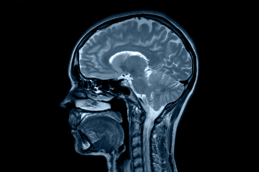 Científicos logran descifrar qué es lo que le sucede al cerebro cuando la mente se queda en ‘blanco’ Científicos logran descifrar qué es lo que le sucede al cerebro cuando la mente se queda en ‘blanco’