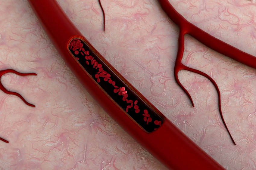 Científicos crean vasos sanguíneos artificiales y marcan un hito en la medicina regenerativa