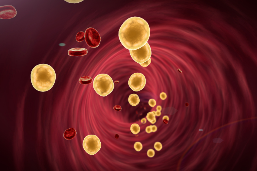 Científicos desarrollan tratamiento para ‘frenar’ la acumulación de colesterol en las arterias Científicos desarrollan tratamiento para ‘frenar’ la acumulación de colesterol en las arterias