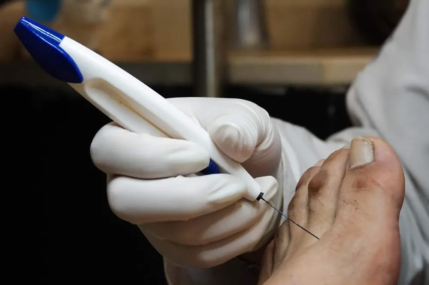 Alertan por aumento de hígado graso y pie diabético en Tamaulipas